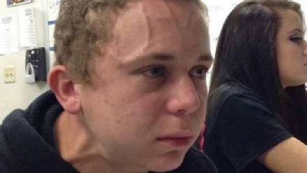 A teenager in a classroom with a deeply furrowed forehead crease, looking stressed